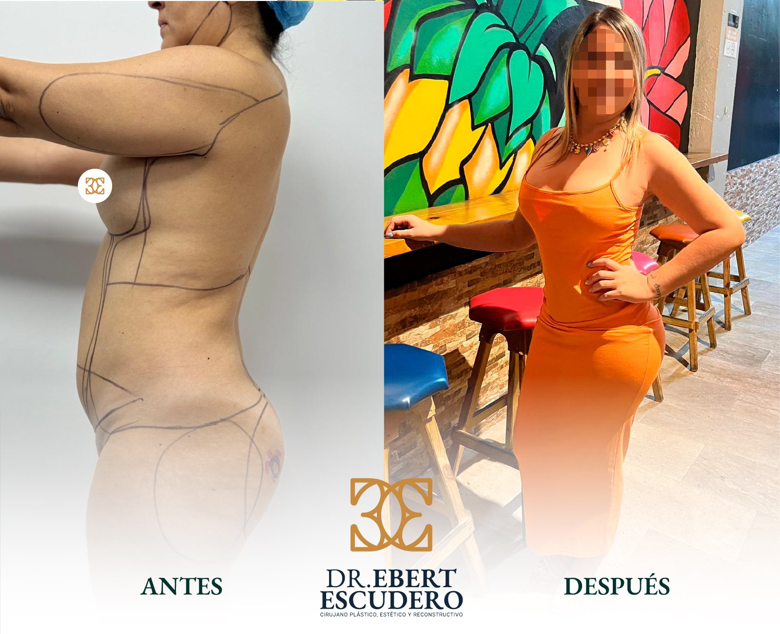 Antes y despues logo nuevo-03