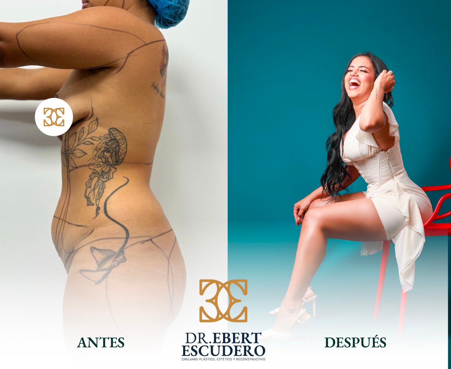 antes y despues-2-1nuevo