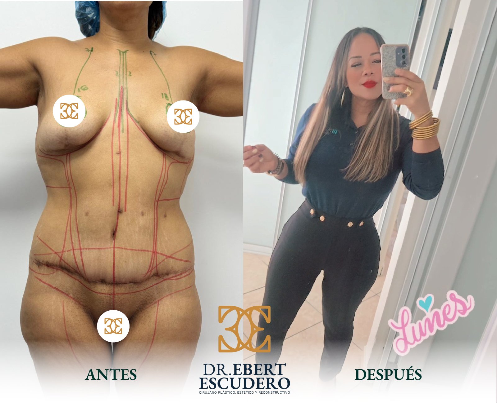 despues dr ebert-17