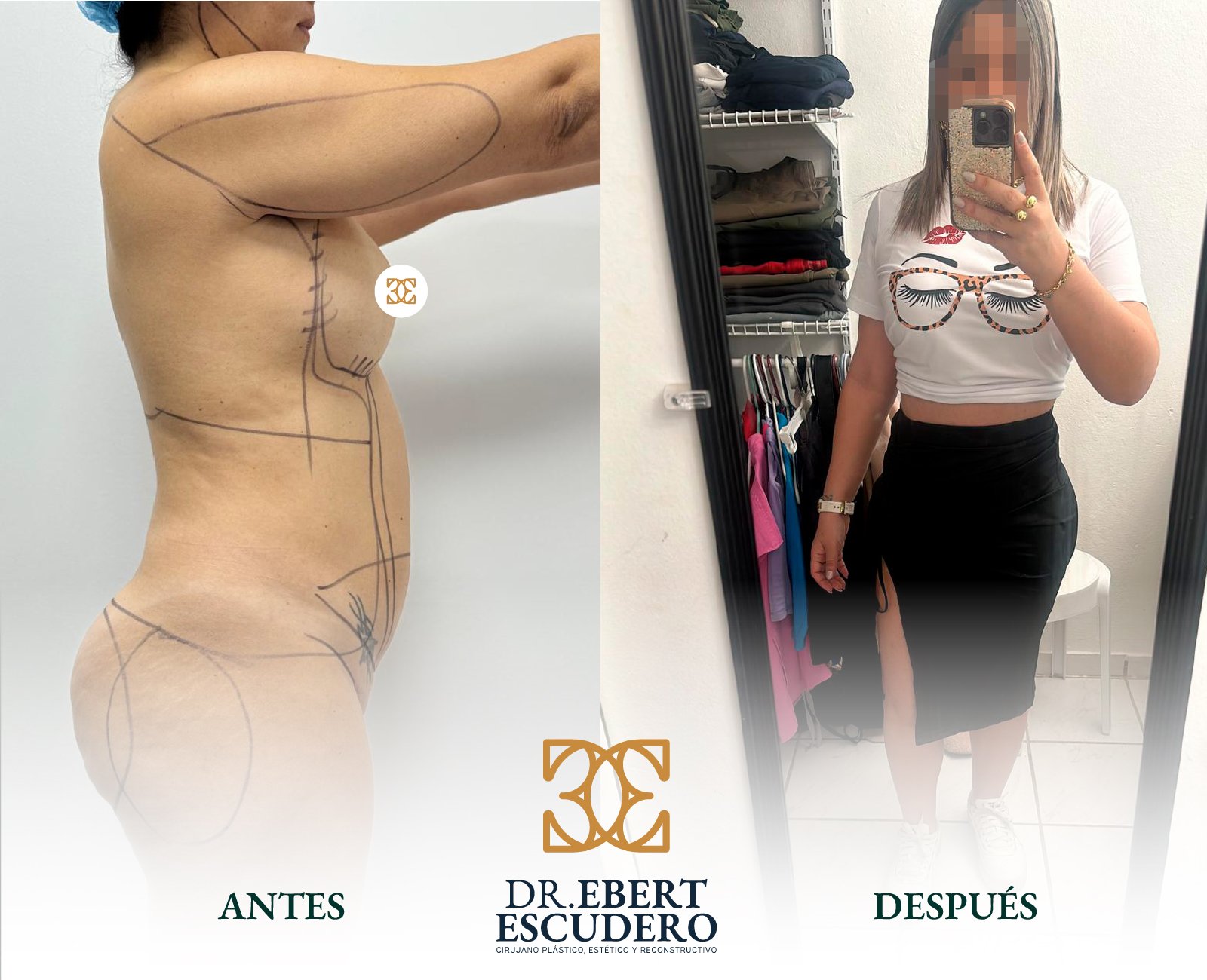 Antes y despues 100-04