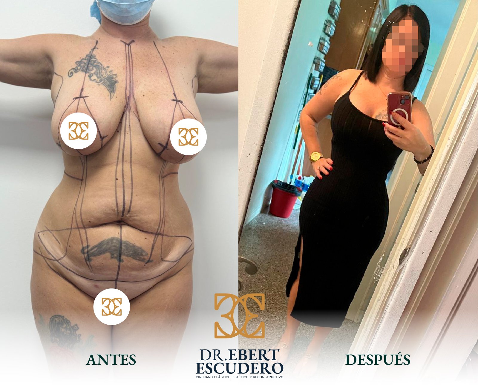 Antes y despues 100-05