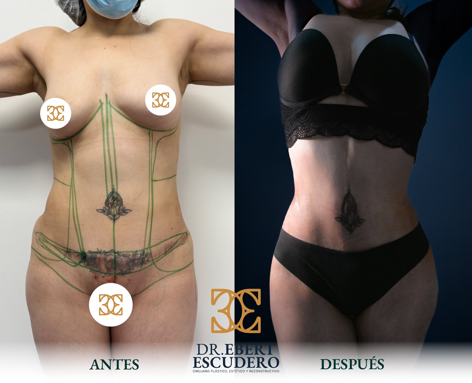 Antes y despues 100