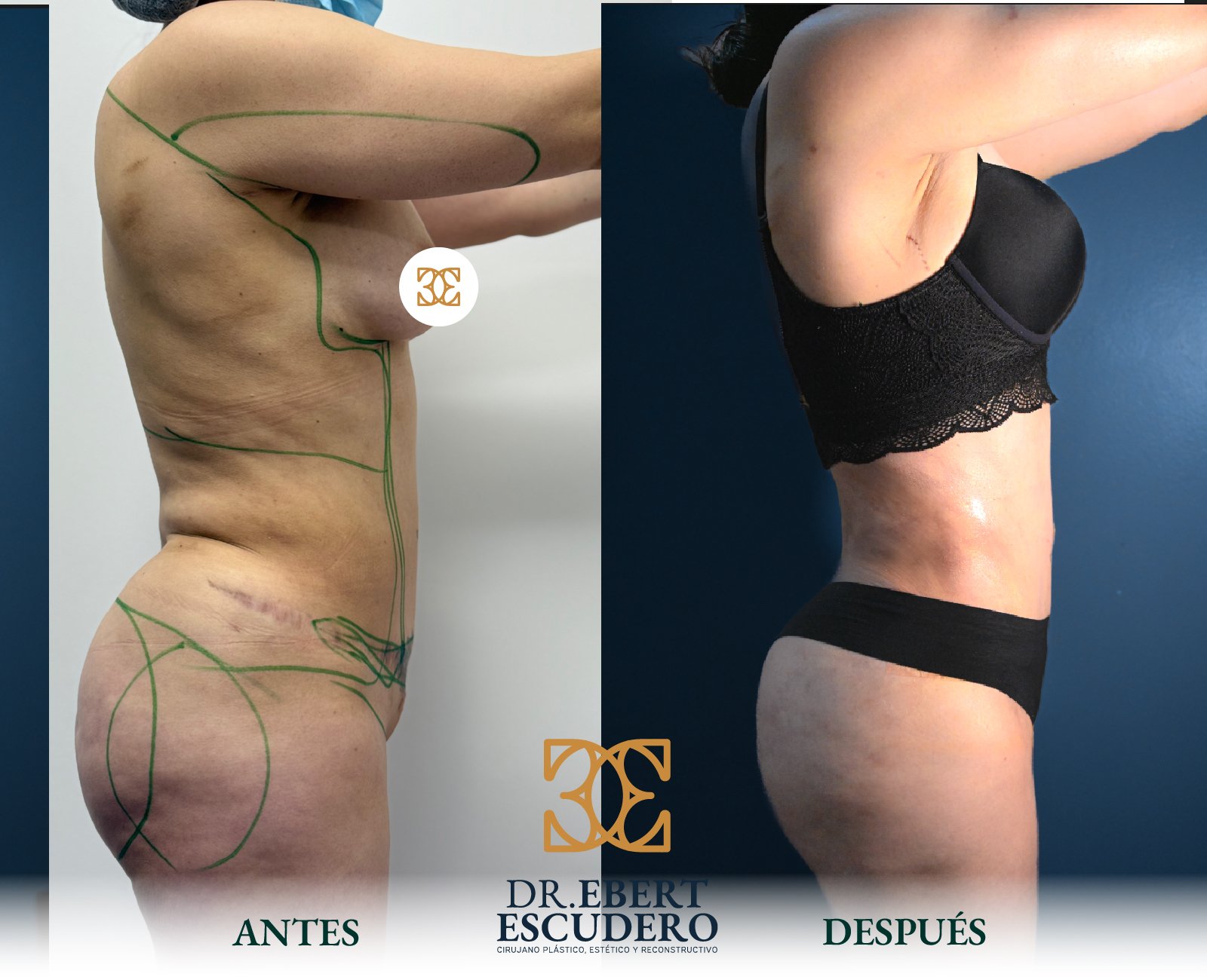 Antes y despues logo nuevo-43