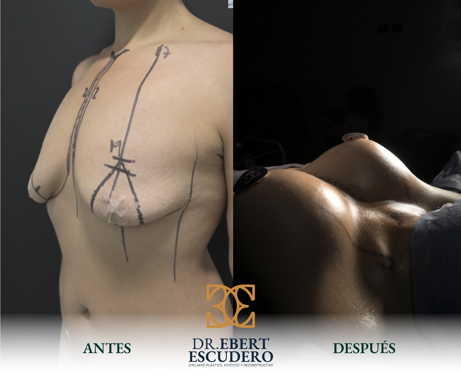 pexia antes y despues-35